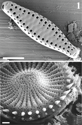 Diatoms are microscopic algae that are sensitive to water quality, and their intricate glass cell walls are preserved in the lake sediment (mud).  Their record in the sediment thus provides a record of water quality.  